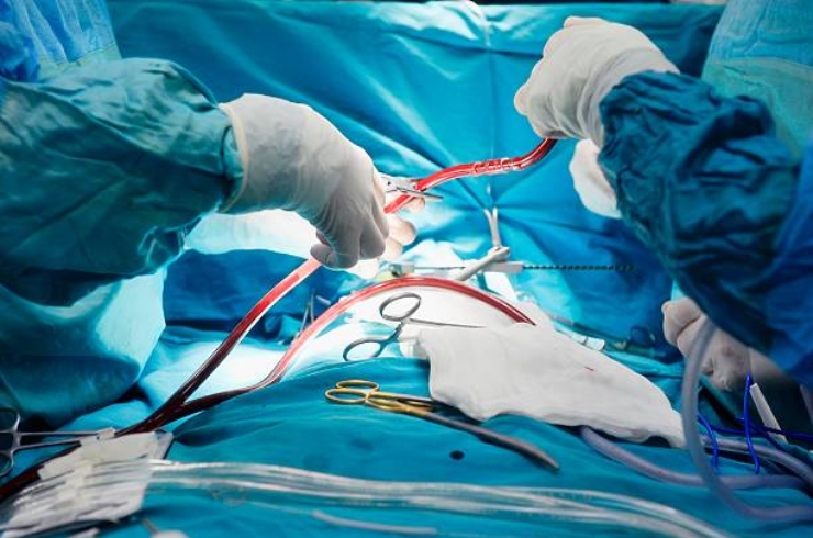 Hepato-biliary Surgery------13